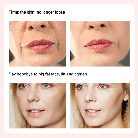 Face-lift Cream Unissex