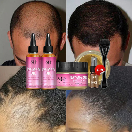 Fast Hair Growth Set