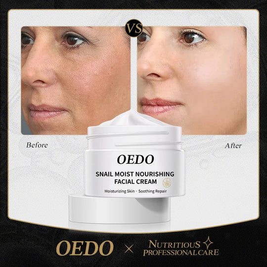 Anti-aging Face Cream